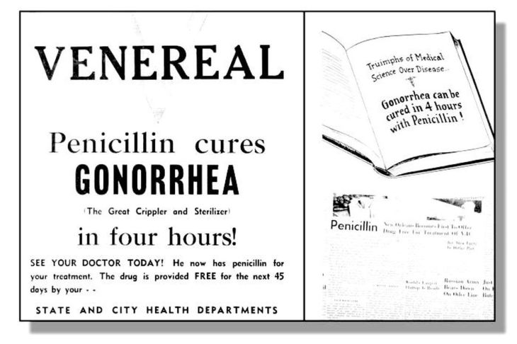 gonorrhea no longer this simple to cure